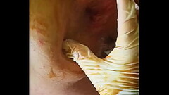 Deep anal training part 1 Thumb